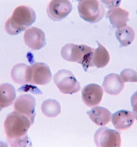 Sıtmaya yol açan Plasmodium parazitinin mikroskop görüntüsü